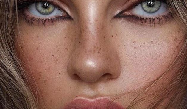 natural freckles